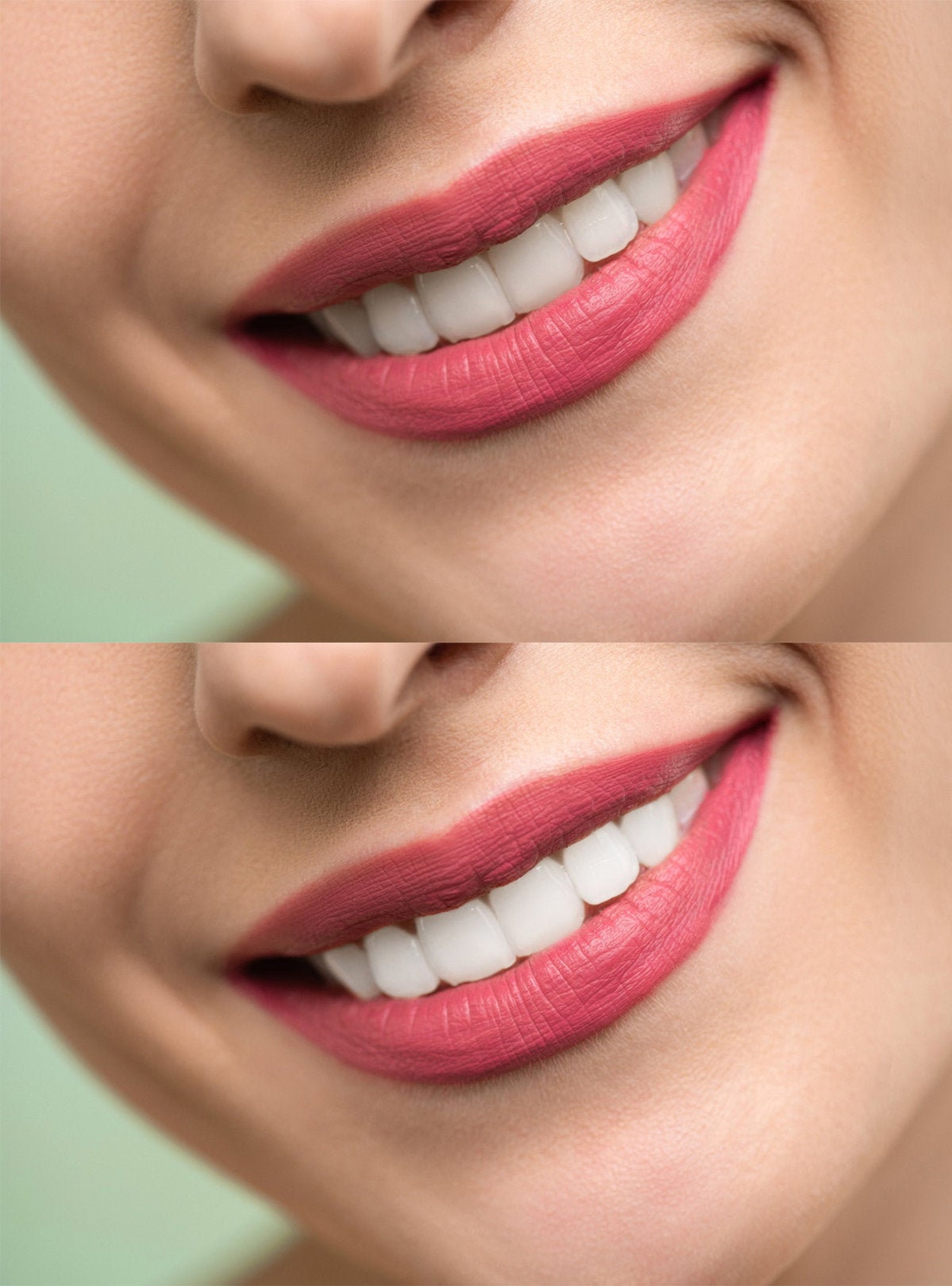 Teeth Whitening Action, Whiten Teeth, Teeth Whitening Preset