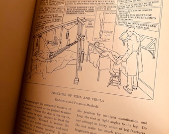 1931 Illustrated Primer on Fractures!