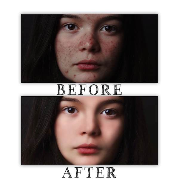 Photo Retouching | Acne Removal | Airbrushing | Touch Ups