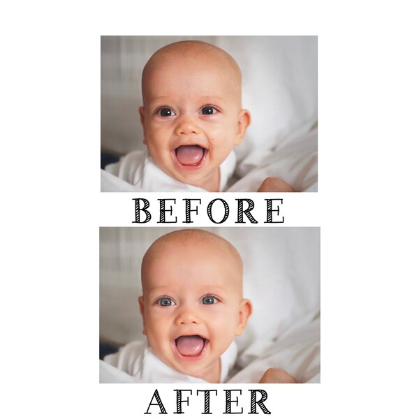 Baby Photo Retouching | Baby Acne | Baby Airbrushing | Baby Touch Ups