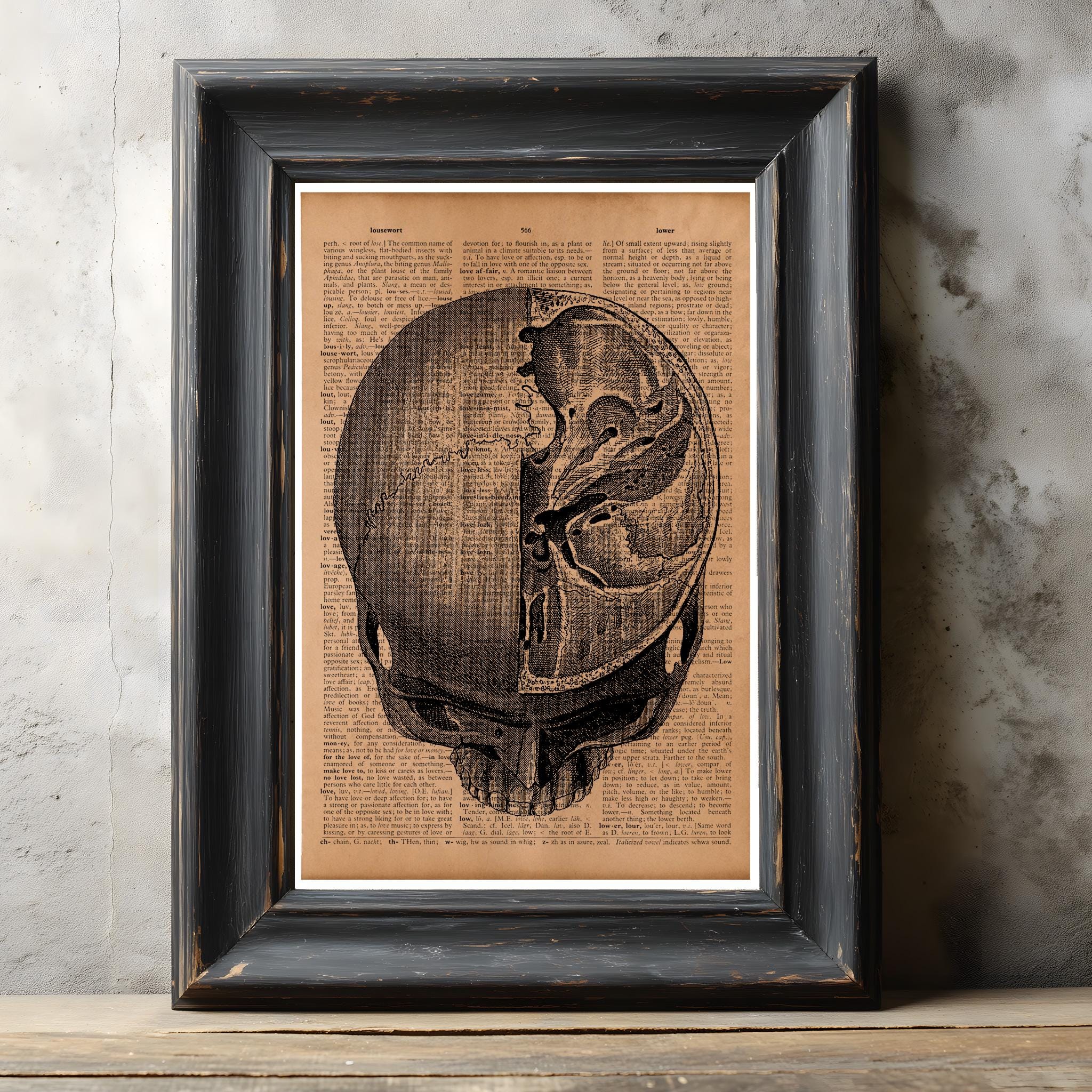 Skull Medical Illustration Print – Vintage Anatomy Wall Chart, Antique ...