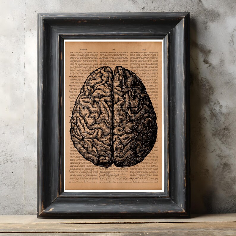 Human Brain Anatomy Art Print – Vintage Medical Illustration Poster ...