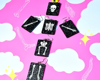 Xray Inspired Earrings, Medical Earrings, XRay Tech Gift