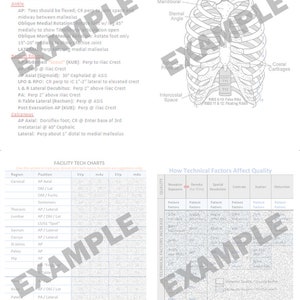 Op de afbeelding: Een zwart-witte anatomische illustratie van de menselijke thorax, die de botten van de ribbenkast, het borstbeen, het sleutelbeen en het schouderblad laat zien. De illustratie bevat labels voor de verschillende delen van de thorax, zoals de jugulaire inkeping, de sternale hoek en de ribkraakbeen.