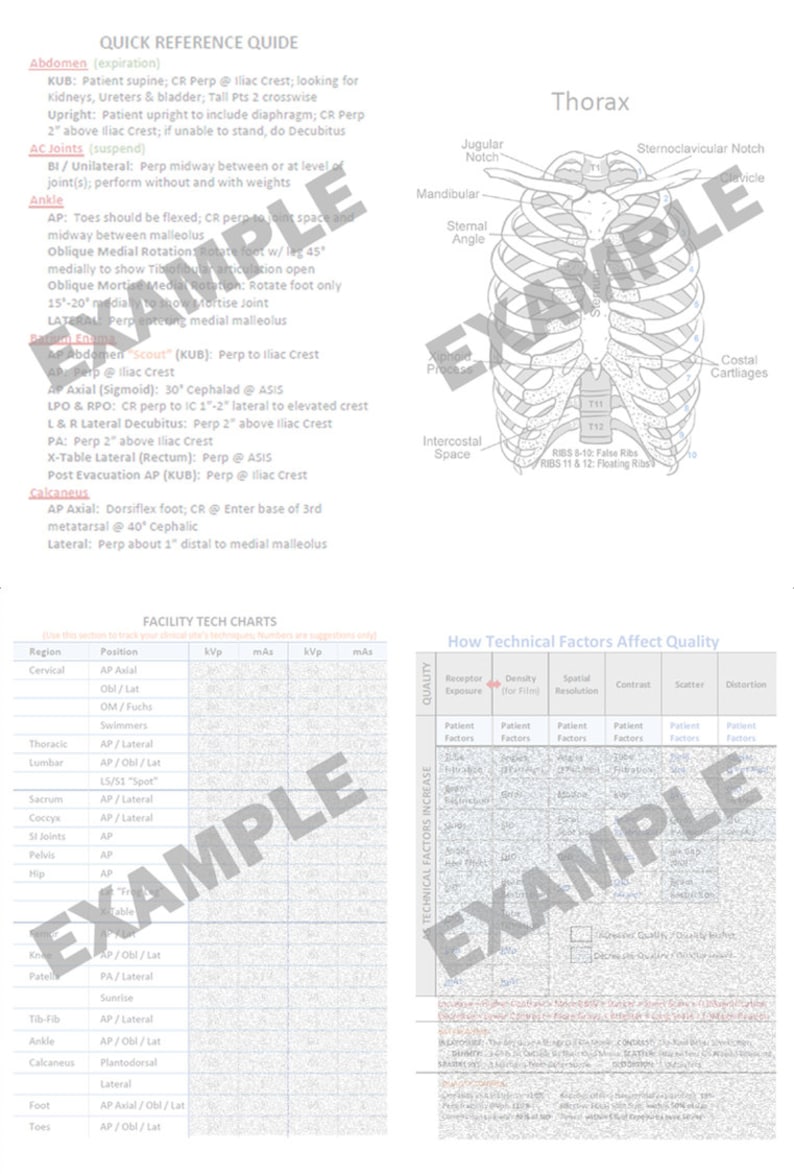 Op de afbeelding: Een zwart-witte anatomische illustratie van de menselijke thorax, die de botten van de ribbenkast, het borstbeen, het sleutelbeen en het schouderblad laat zien. De illustratie bevat labels voor de verschillende delen van de thorax, zoals de jugulaire inkeping, de sternale hoek en de ribkraakbeen.