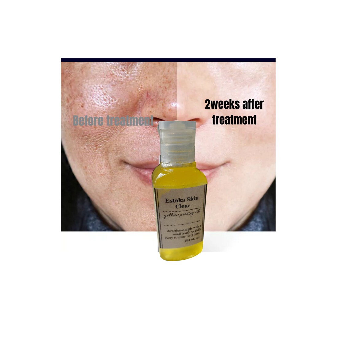 Concentrated Vitamin C Yellow peeling oil for face spots and Etsy