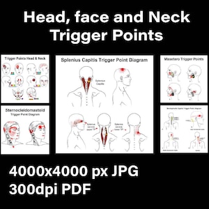 Puede incluir: Diagrama que muestra los puntos gatillo en la cabeza, la cara y el cuello. El diagrama muestra la ubicación de los puntos gatillo en los músculos esplenio de la cabeza, esternocleidomastoideo y masetero. El diagrama está etiquetado con los nombres de los músculos y los puntos gatillo.