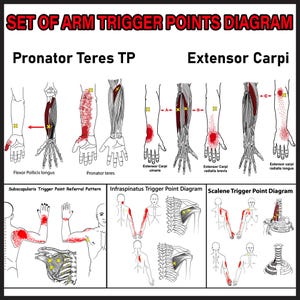 Op de afbeelding: Anatomiediagram met triggerpoints in de arm, inclusief Pronator Teres en Extensor Carpi. De afbeelding toont spierillustraties met gemarkeerde triggerpoints en labels zoals Flexor Pollicis longus en Extensor Carpi ulnaris. De titel luidt "SET OF ARM TRIGGER POINTS DIAGRAM".