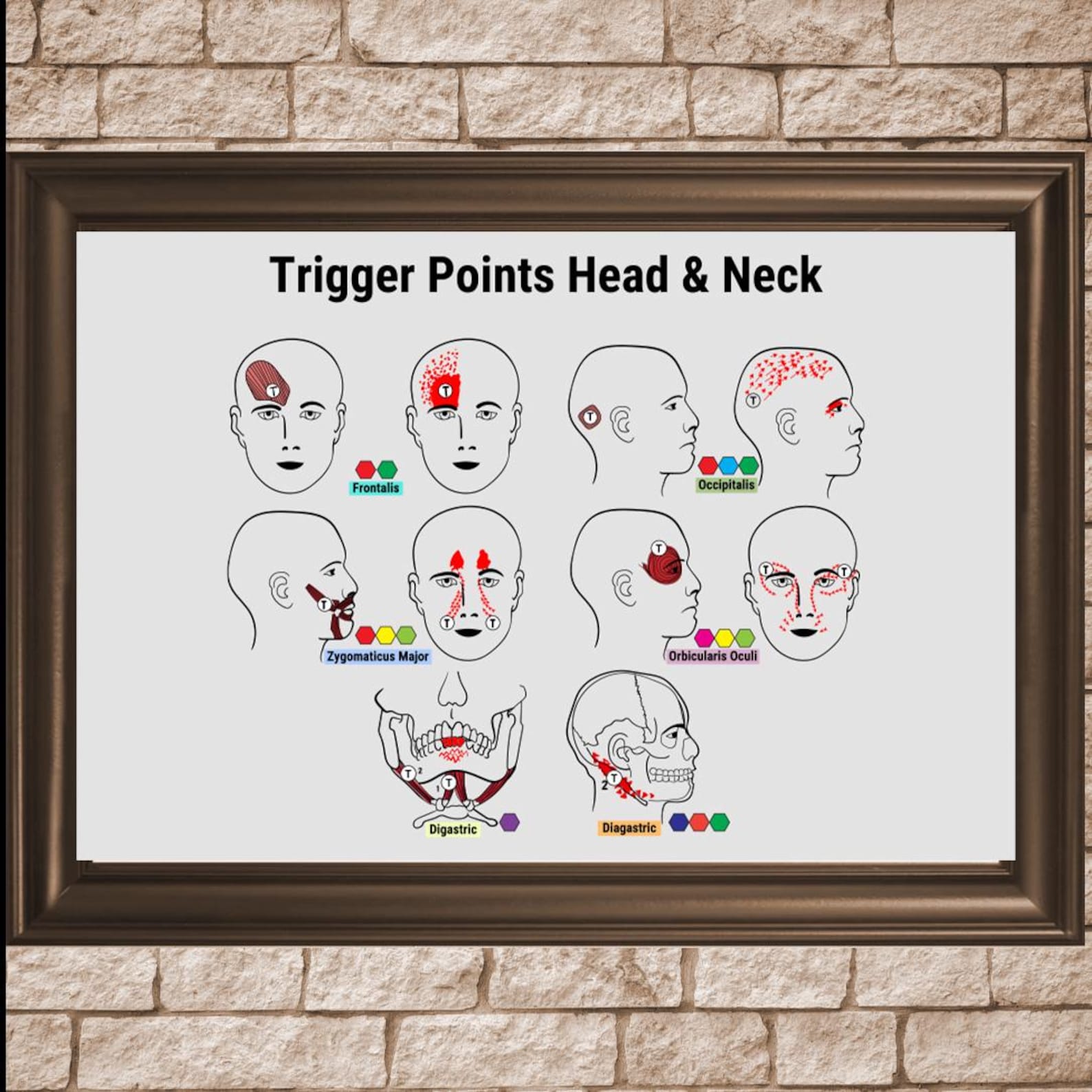 Trigger Point Reference Chart Head & Neck Trigger Point Charts: Muscle Pain Relief Diagrams (PDF) - Etsy