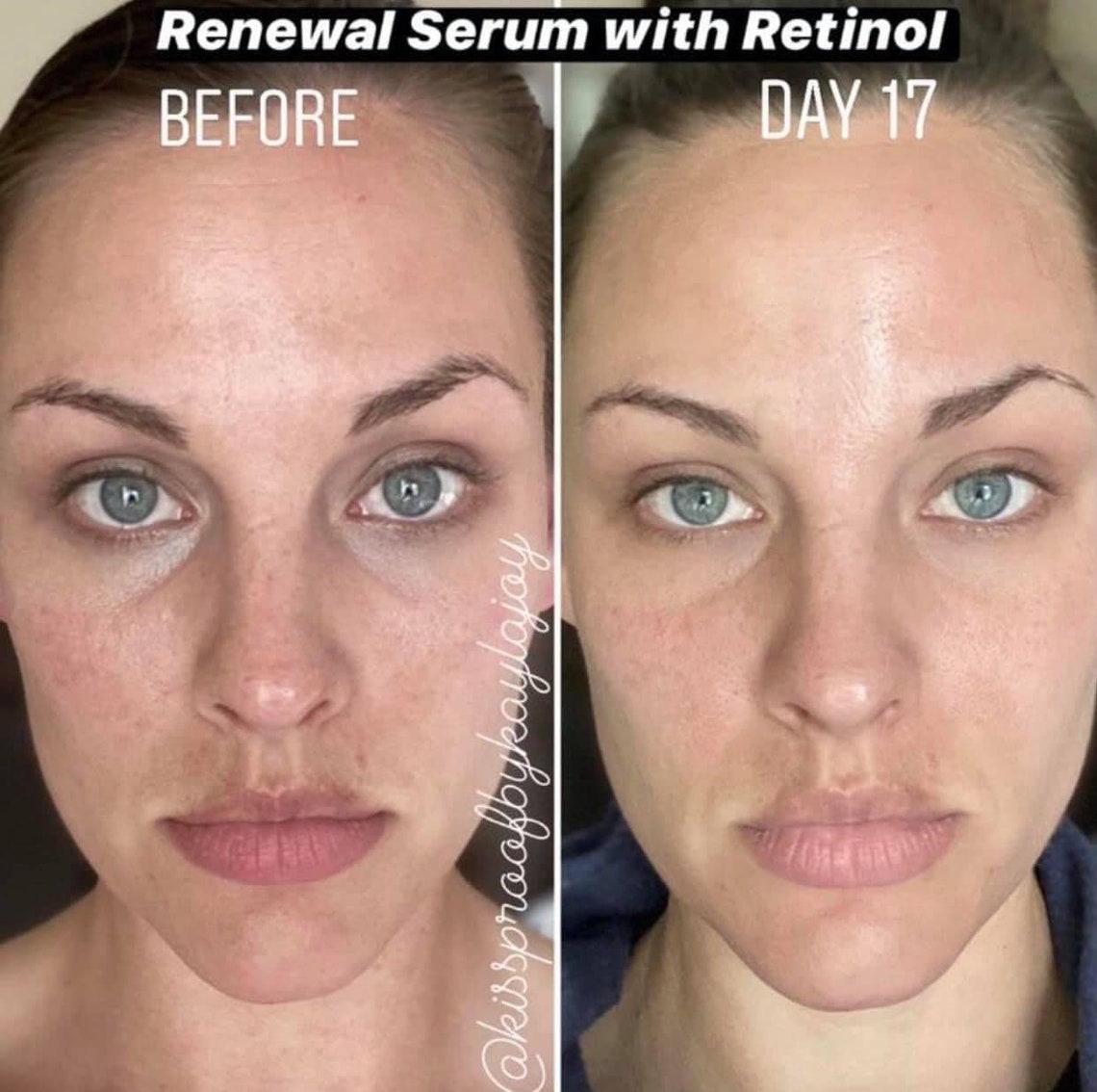 senegence-advanced-seneplex-renewal-serum-with-retinol-etsy