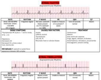 A Flutter & A Fib EKG interpretation