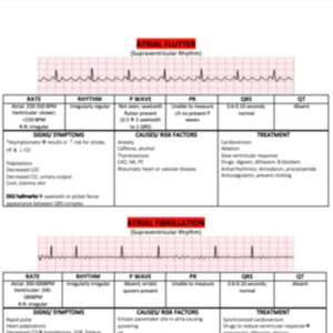 A Flutter & A Fib EKG interpretation