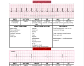 Sinus Dysrhythmia's, EKG Interpretation