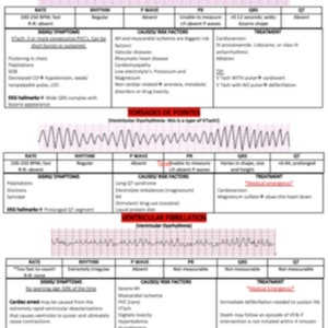 Ventricular Dysrhythmias