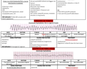 Ventricular Dysrhythmias