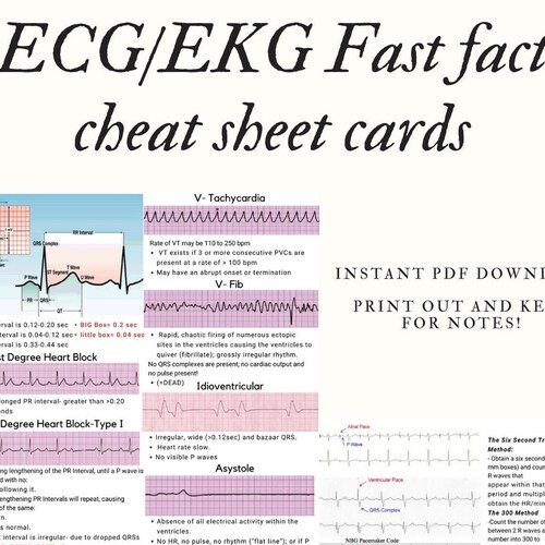 ECG/EKG Fast Fact Cheat Sheet Card - Etsy