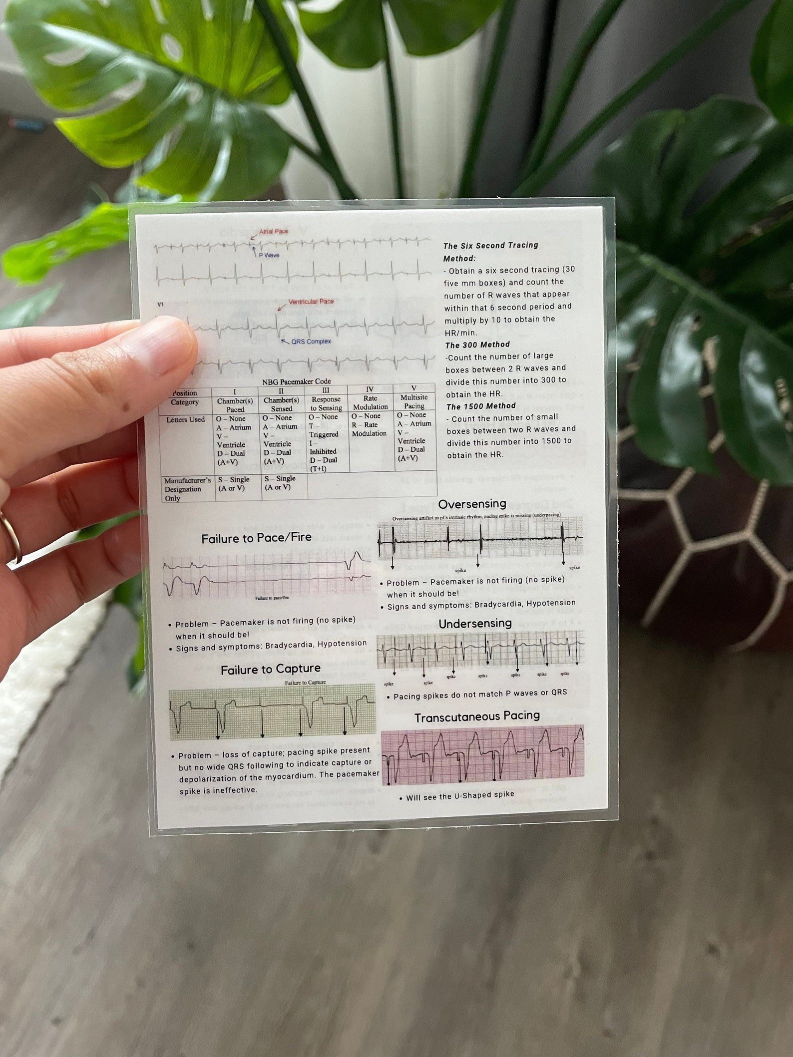 ECG/EKG Fast Fact Cheat Sheet Card - Etsy