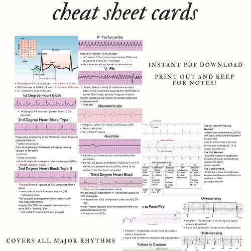 ECG/EKG Fast Fact Cheat Sheet Card - Etsy UK