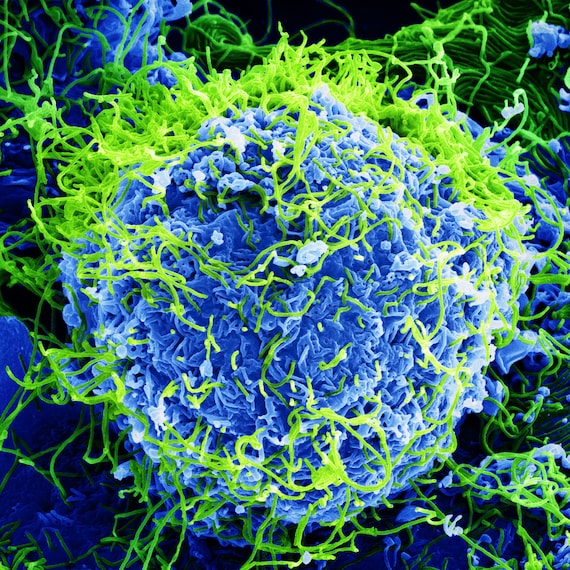 Virus Electron Microscope Color