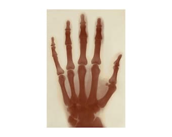 Nikola Tesla’s Left Hand X-Ray Xray Radiograph Photo Poster Art Print