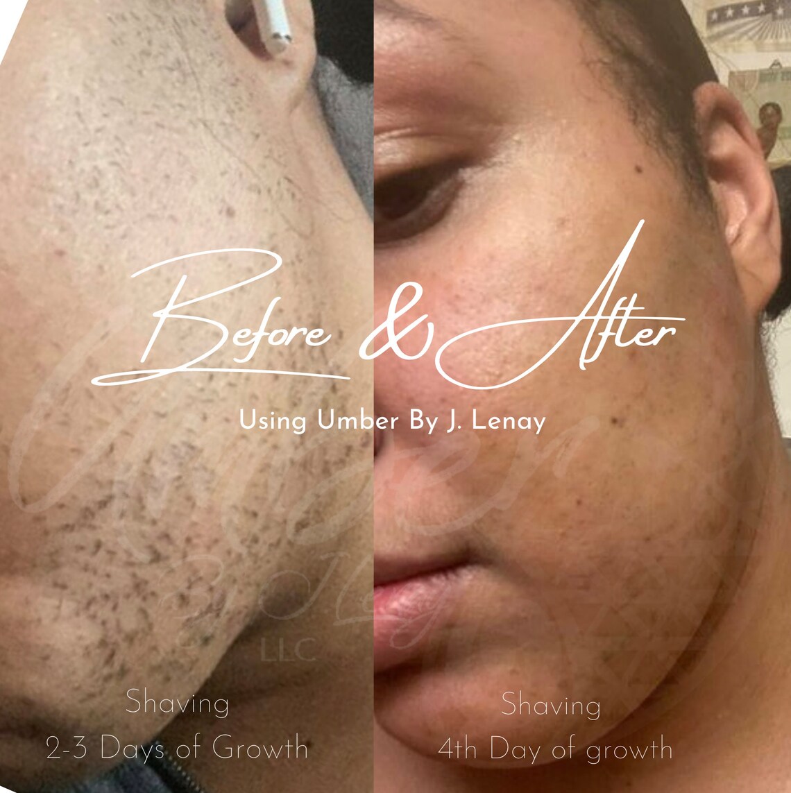 Hair Reducing Fade Oil Hair Inhibitor Hair Removal PCOS Etsy