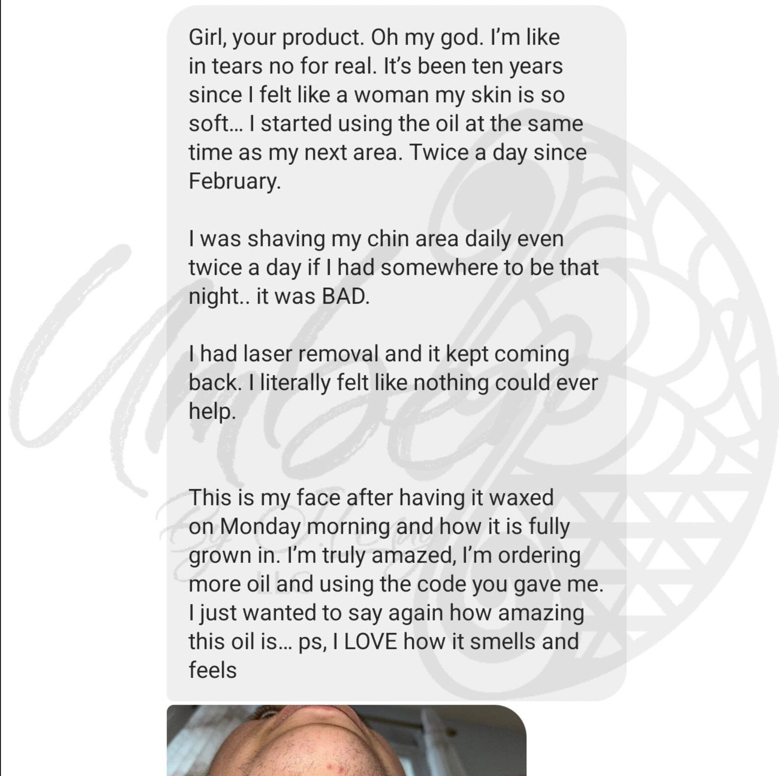 Hair Reducing Fade Oil Hair Inhibitor Hair Removal PCOS Etsy