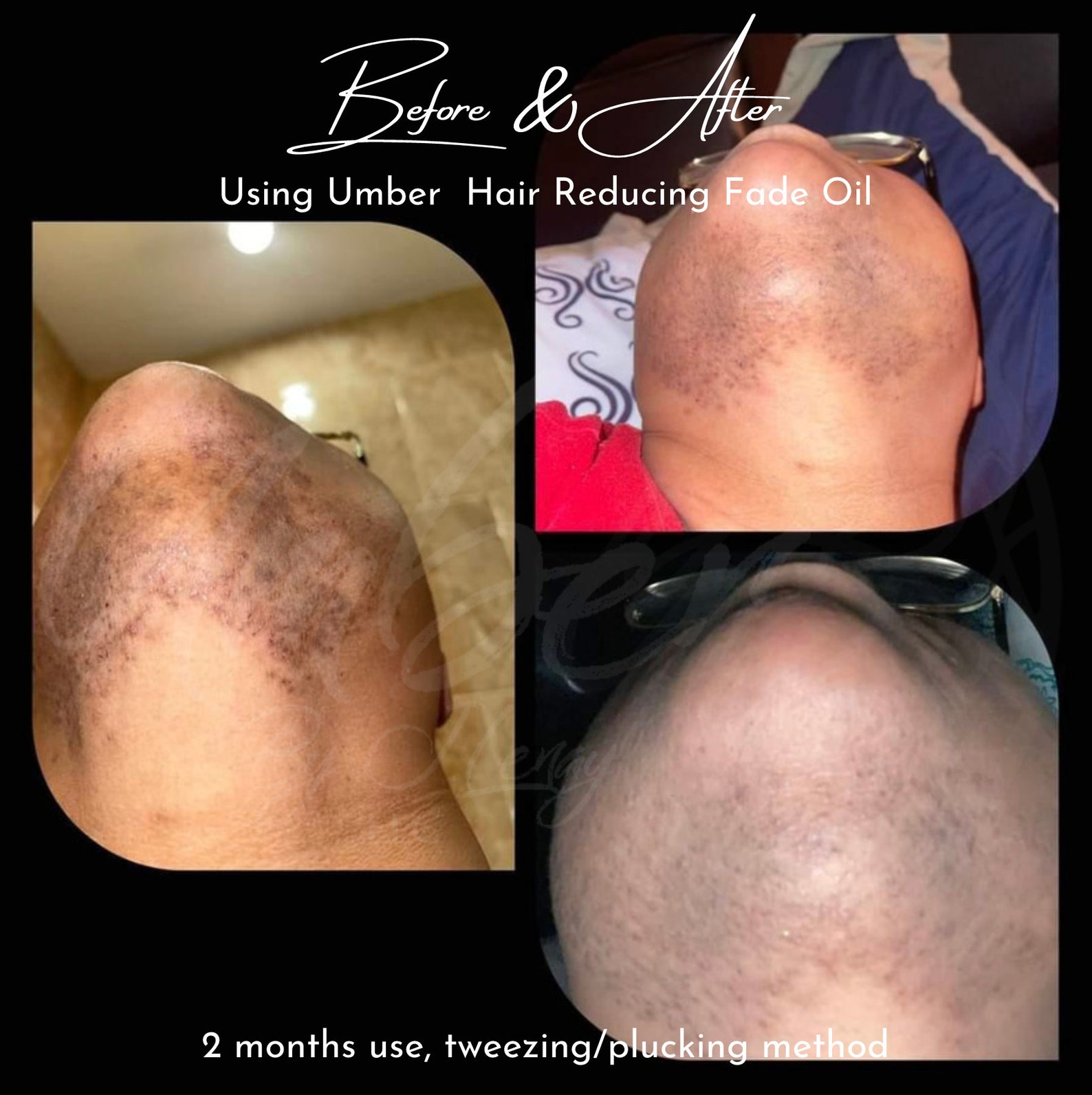 Hair Reducing Fade Oil Hair Inhibitor Hair Removal PCOS / Etsy