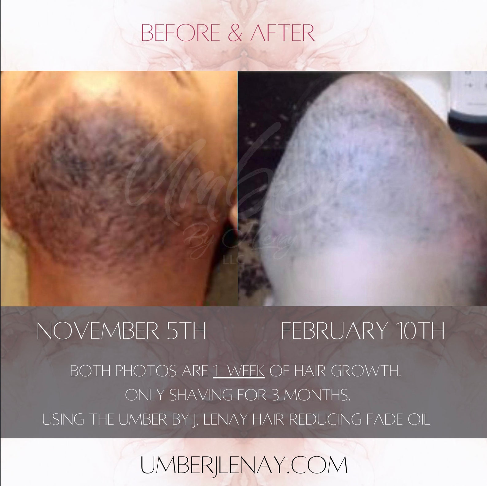 Hair Reducing Fade Oil Hair Inhibitor Hair Removal PCOS Etsy