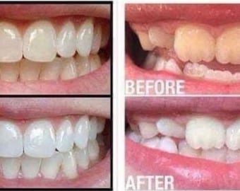 AP 24 Whitening Toothpaste by NuSkin