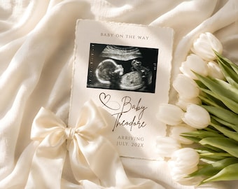 Plantilla de anuncio de embarazo en Canva, plantilla editable para revelar el nacimiento del bebé mediante ecografía, elegante letrero de anuncio de embarazo con tulipán blanco.
