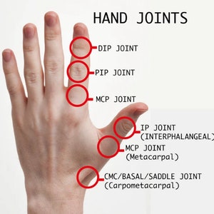 May include: Diagram of a hand showing the different joints, labelled with their names: DIP, PIP, MCP, IP (Interphalangeal), MCP (Metacarpal), CMC/Basal/Saddle (Carpometacarpal).