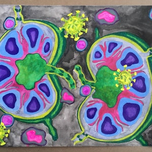 May include: A watercolour painting depicting two green, blue and purple kidney-shaped organs with yellow and green viruses surrounding them. The background is a dark grey.