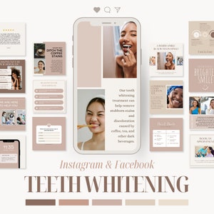 Puede incluir: Gráfico de marketing digital para servicios de blanqueamiento dental. El diseño presenta una maqueta de teléfono inteligente con varios paneles informativos, que incluyen fotos de antes y después y detalles del servicio. La paleta de colores es neutra con tonos beige y marrón.
