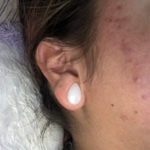 Puede incluir: Primer plano de la oreja de una persona con un expansor de oreja blanco en forma de l&aacute;grima. El expansor est&aacute; hecho de un material liso y pulido.