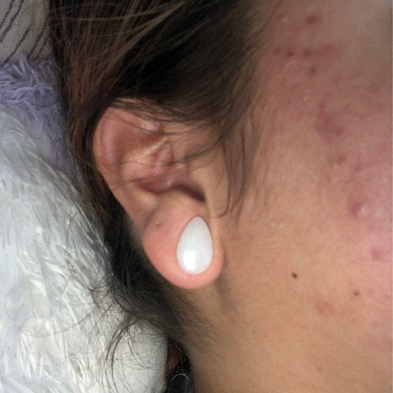 Puede incluir: Primer plano de la oreja de una persona con un expansor de oreja blanco en forma de l&aacute;grima. El expansor est&aacute; hecho de un material liso y pulido.