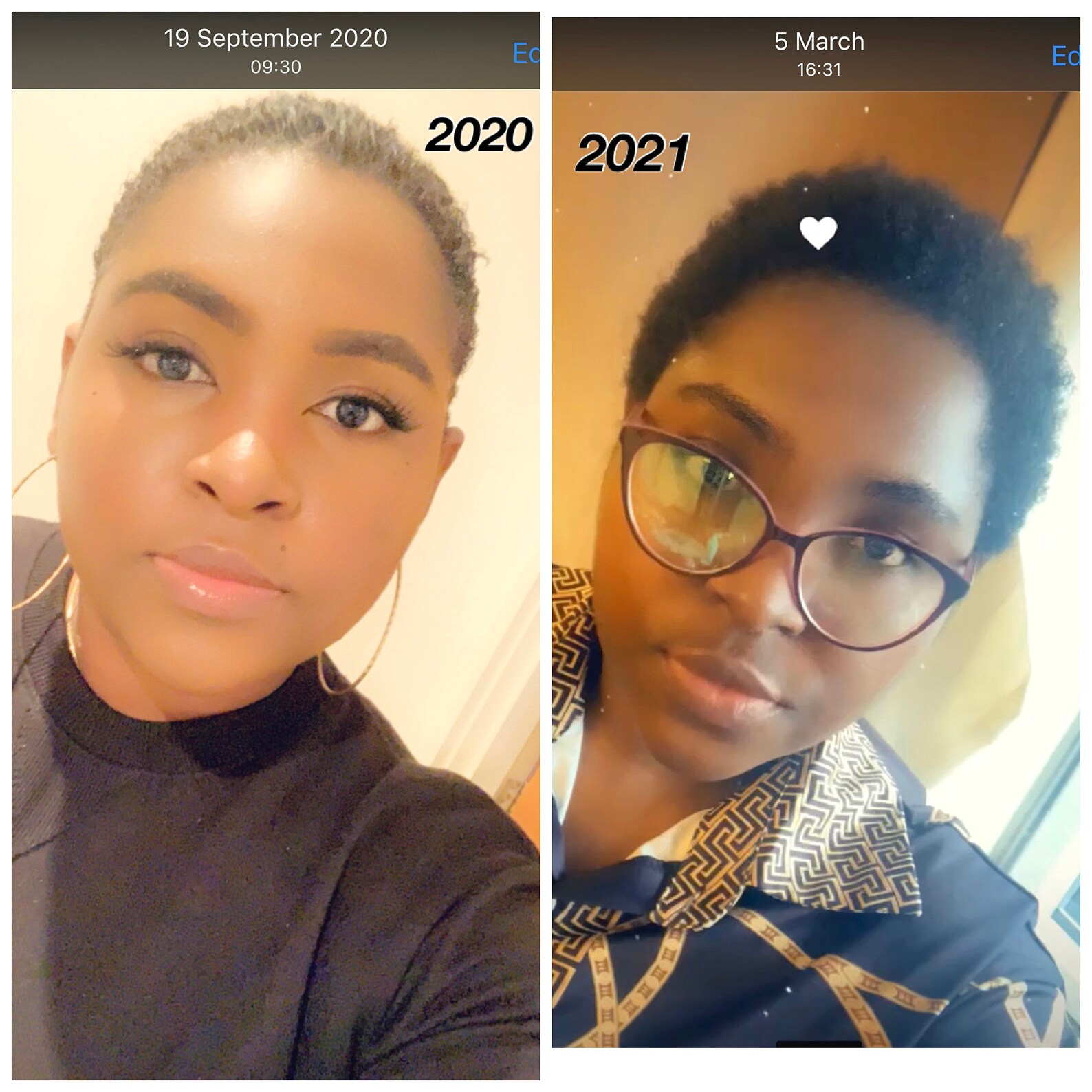 Ayurvedic Hair Food for Men and Women. Brahmi & Amla Oil Hair Etsy UK