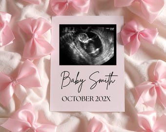Coquette Bow Pregnancy Announcement Digital Editable Template Romantic Bow Girl Baby Reveal, Bow Minimalist Pregnancy Announcement