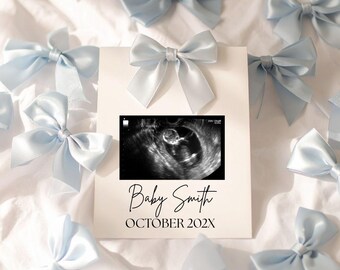 Coquette Bow Pregnancy Announcement Digital Editable Template Romantic Bow Boy Baby Reveal, Bow Minimalist Pregnancy Announcement