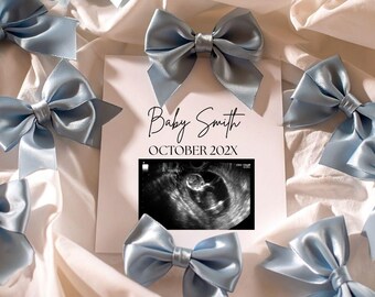 Coquette Bow Pregnancy Announcement Digital Editable Template Romantic Bow Boy Baby Reveal, Bow Minimalist Pregnancy Announcement