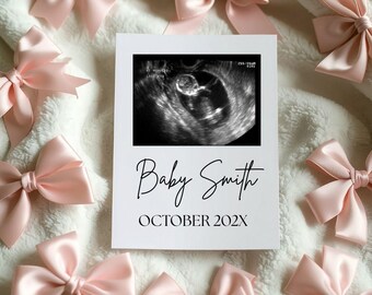 Coquette Bow Pregnancy Announcement Digital Editable Template Romantic Bow Girl Baby Reveal, Bow Minimalist Pregnancy Announcement