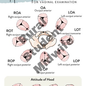 Head Presentation diagram from the Midwifery Student Additional Care Guide