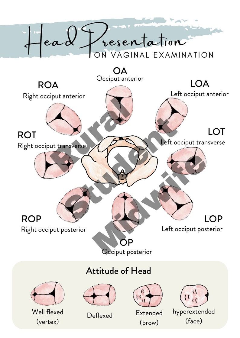 Head Presentation diagram from the Midwifery Student Additional Care Guide