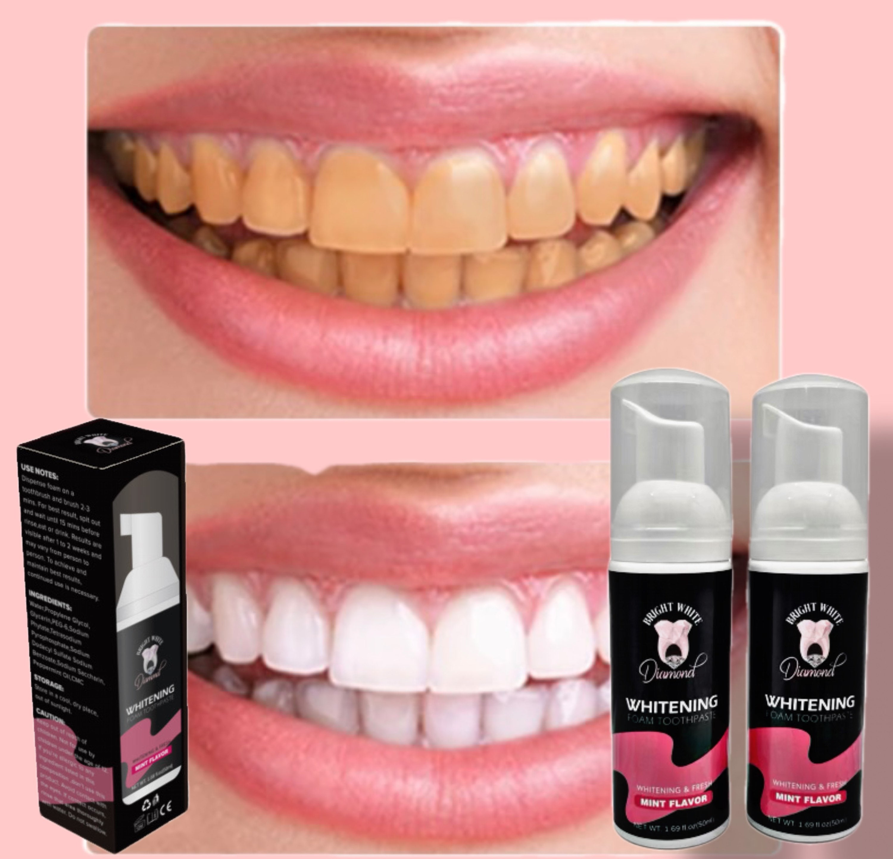 Deluxe Teeth Whitening FOAM 1 Whitening Foam That Removes Etsy
