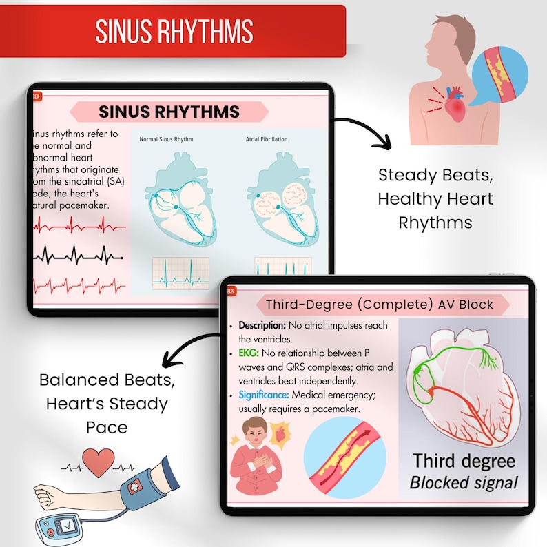 EKG Heart Rhythm Flashcards: Medical Nursing Study Guide (digital ...