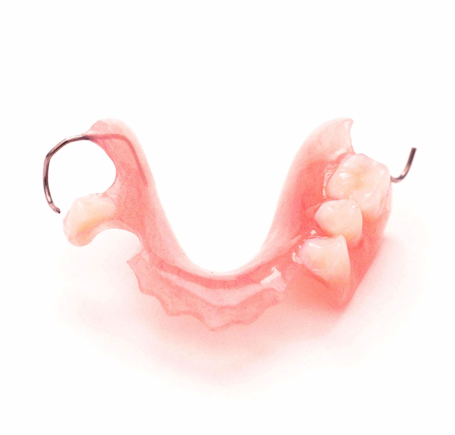 MISSING TEETH FLIPPER Stayplate New Custom Impression Kit Etsy