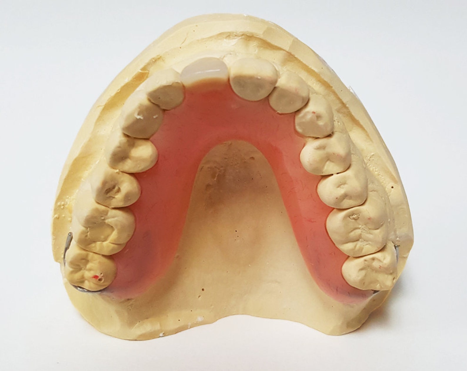 MISSING TEETH FLIPPER Stayplate New Custom Impression Kit Etsy