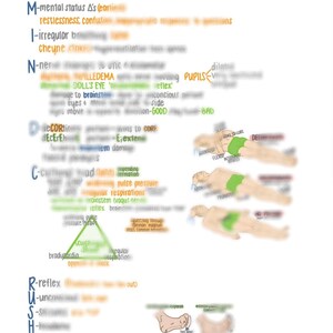 Può includere: Un grafico scritto a mano con un triangolo verde e testo che descrive i segni e i sintomi di un crollo mentale. Il grafico include l'acronimo RUSH-ED, che sta per Riflesso, Incosciente, Dimensione, Emiplegia, Emesi, Deterioramento. Il grafico include anche un diagramma di una persona sdraiata sulla schiena con braccia e gambe in diverse posizioni.