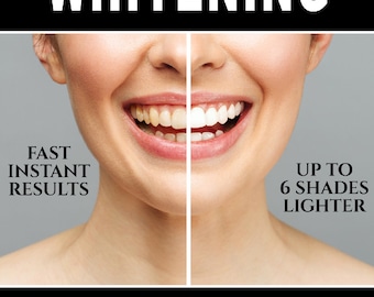 Texto laminado a medida Anuncio Cartel Aviso Aviso Negocio Belleza Dental Dentista Salón Servicio de blanqueamiento dental disponible aquí