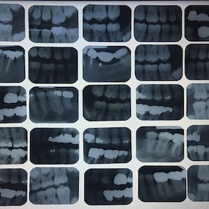 Películas de rayos X dentales antiguas. Dentista. Víspera de Todos los Santos. Rarezas.