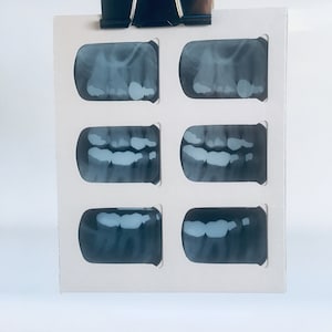 Equipos de rayos X dentales vintage en soporte de cartón